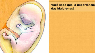 Hialurona